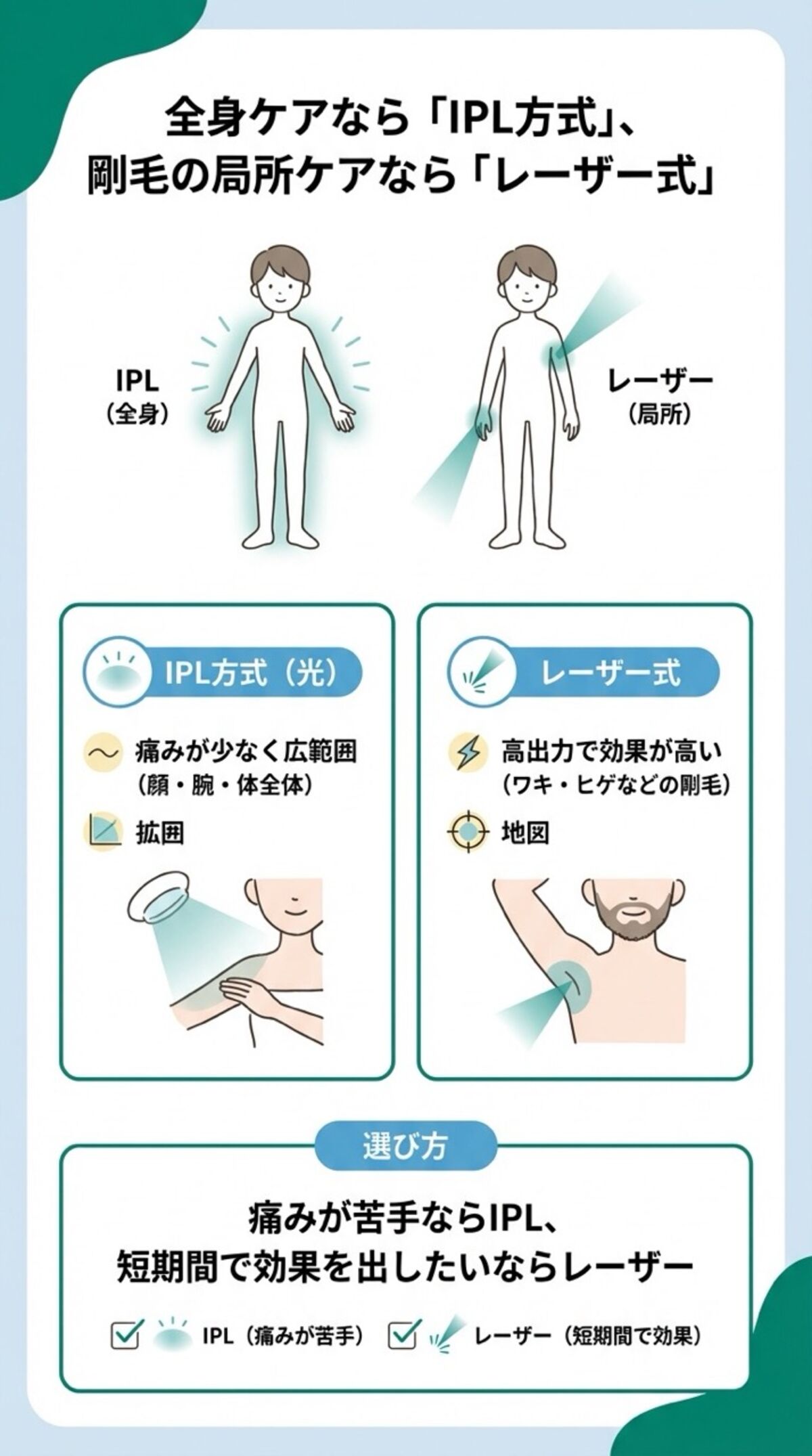 全身ケアならIPL方式、剛毛の局所ケアならレーザー式