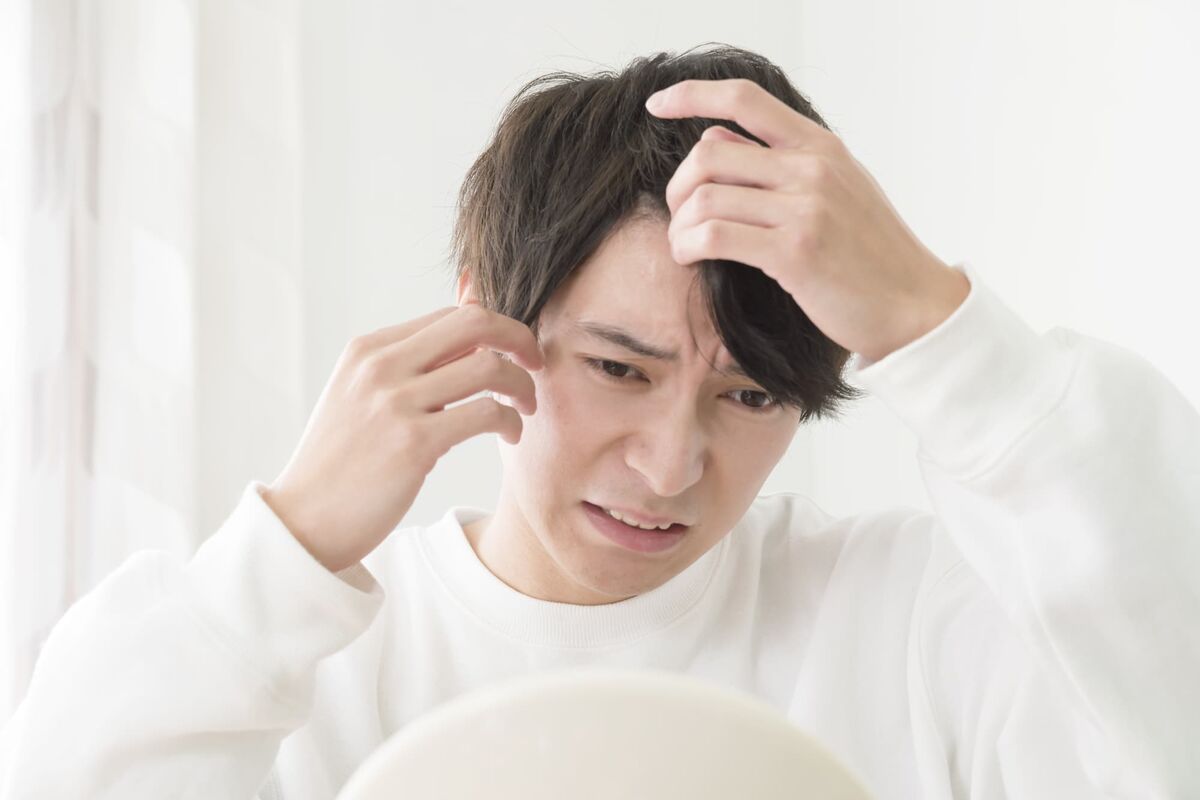 発毛剤