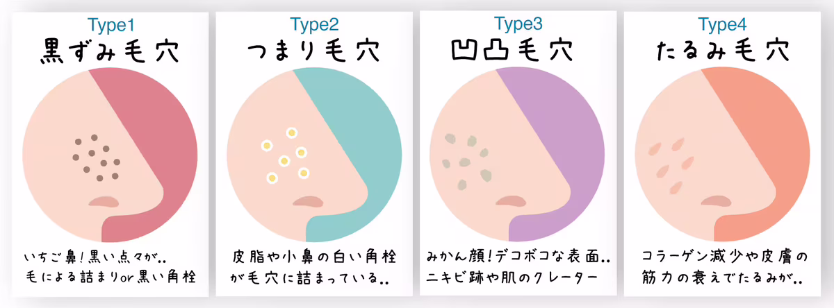 毛穴の種類