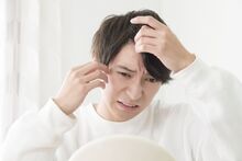 発毛剤
